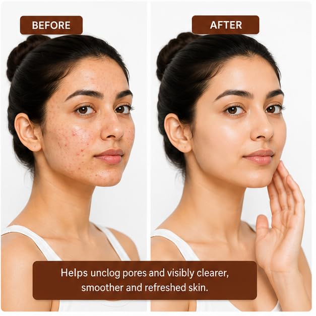 Hanira Skincare 1% Salicylic Acid Face Wash for Men & Women | Helps Unclog Pores, Remove Impurities & Reduce Excess Oil and Shine | Gentle Daily Face Cleanser | For All Skin Types | 150 ml