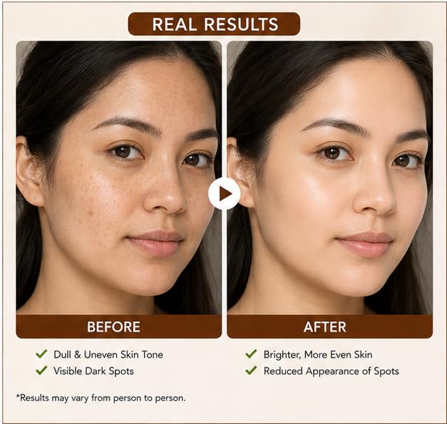Hanira Skincare Alpha Arbutin 2% Serum, Dark Spot and Texture Corrector, Revitalizer, 30ml (1.01 fl oz)