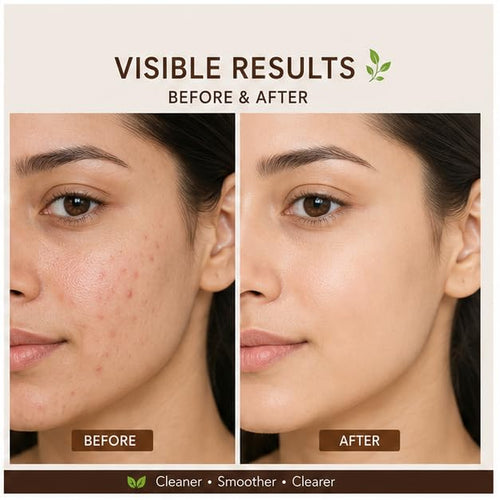 Hanira 1% Salicylic Acid Face Serum for Daily Skincare, Lightweight Fast Absorbing Facial Serum for Oily & Blemish-Prone Skin, Suitable for Daily Use, 30 ml